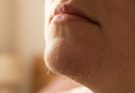 Women’s Chin Hair: Causes and Confident Ways to Handle It
