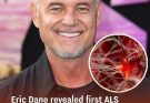 Eric Dane revealed first ALS symptom he noticed that led to diagnosis before death aged 53